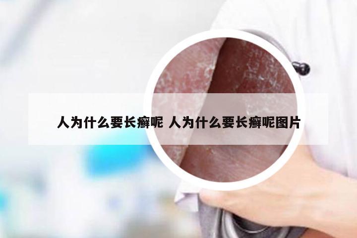 人为什么要长癣呢 人为什么要长癣呢图片