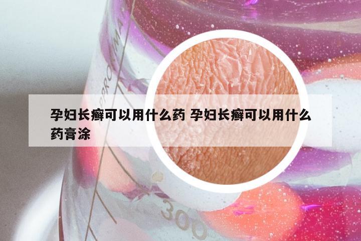 孕妇长癣可以用什么药 孕妇长癣可以用什么药膏涂