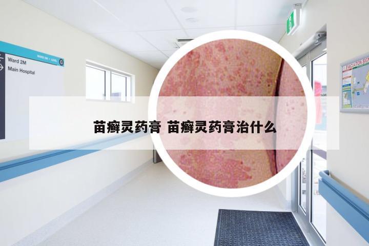 苗癣灵药膏 苗癣灵药膏治什么