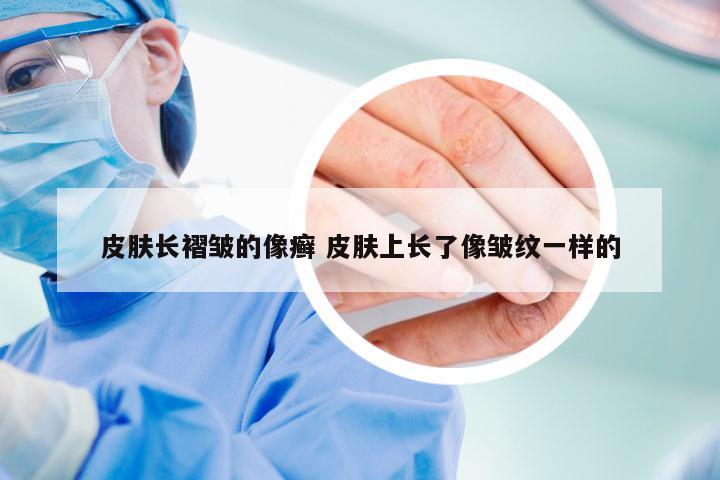 皮肤长褶皱的像癣 皮肤上长了像皱纹一样的