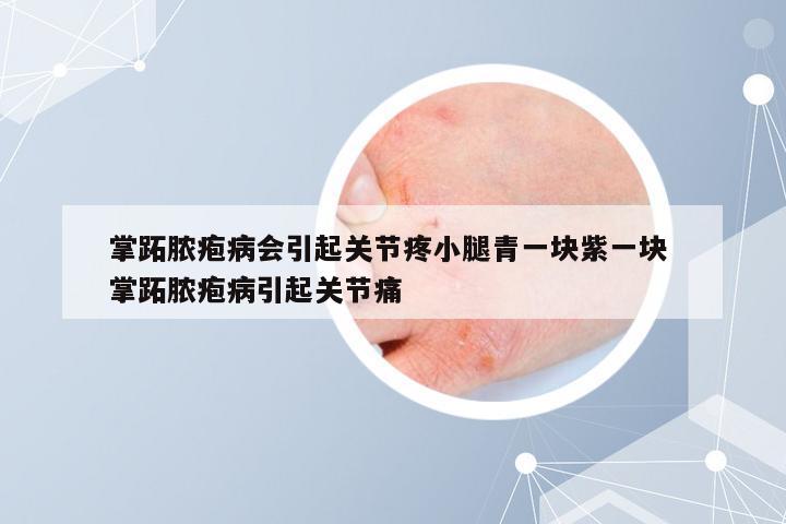 掌跖脓疱病会引起关节疼小腿青一块紫一块 掌跖脓疱病引起关节痛