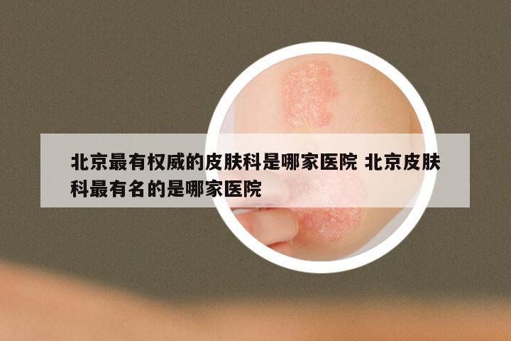 北京最有权威的皮肤科是哪家医院 北京皮肤科最有名的是哪家医院