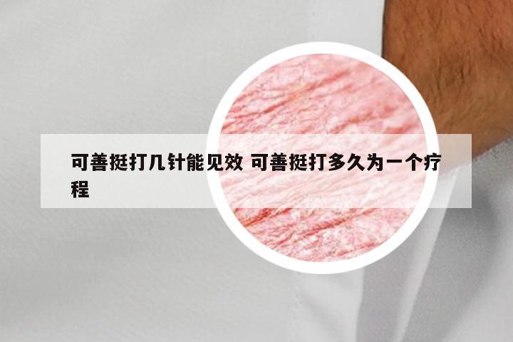 可善挺打几针能见效 可善挺打多久为一个疗程