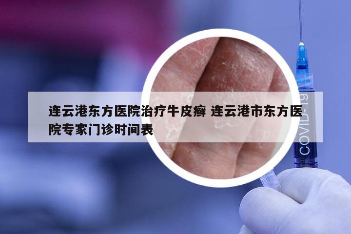连云港东方医院治疗牛皮癣 连云港市东方医院专家门诊时间表