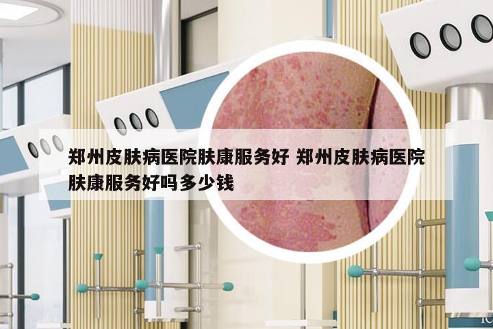 郑州皮肤病医院肤康服务好 郑州皮肤病医院肤康服务好吗多少钱