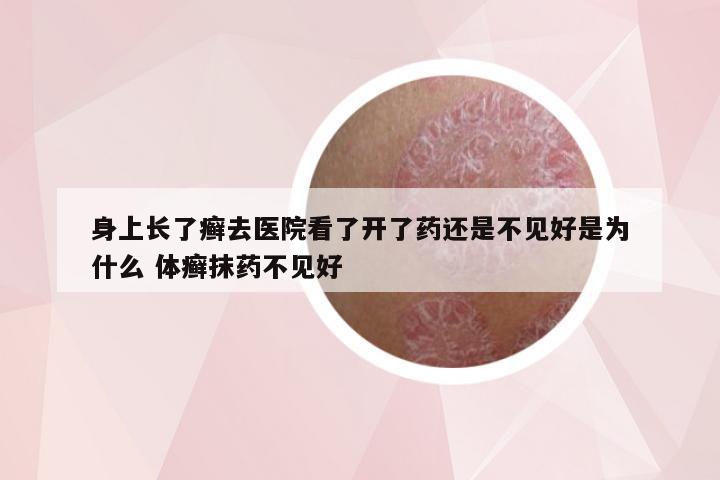 身上长了癣去医院看了开了药还是不见好是为什么 体癣抹药不见好