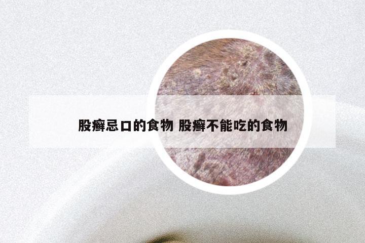 股癣忌口的食物 股癣不能吃的食物
