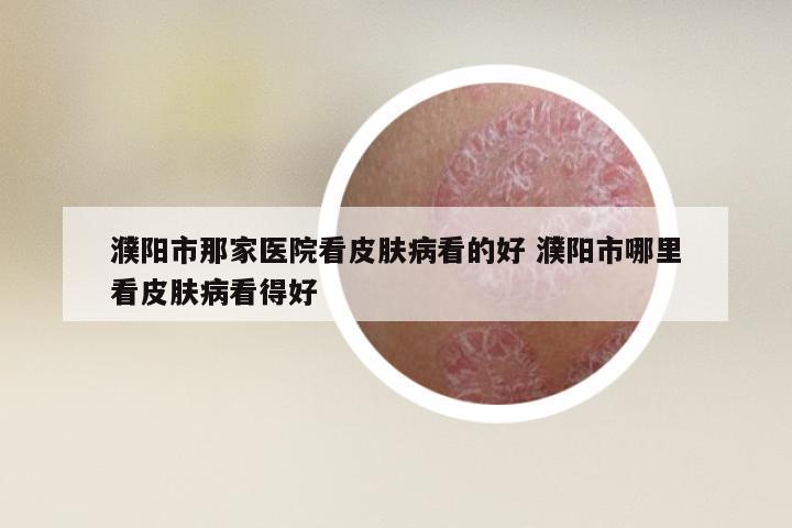 濮阳市那家医院看皮肤病看的好 濮阳市哪里看皮肤病看得好