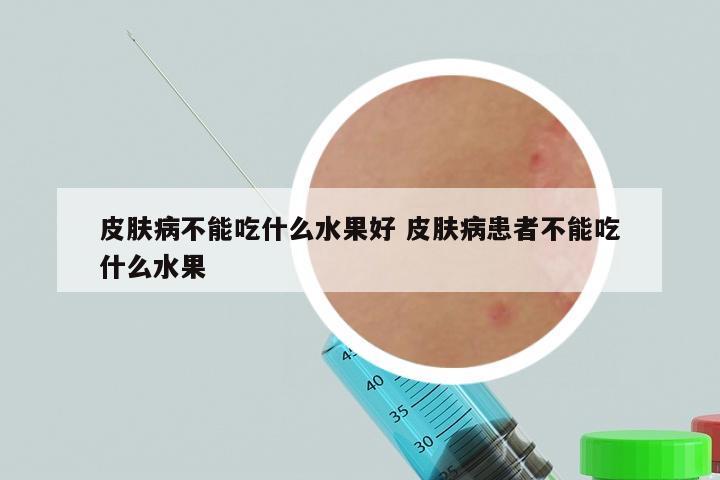 皮肤病不能吃什么水果好 皮肤病患者不能吃什么水果