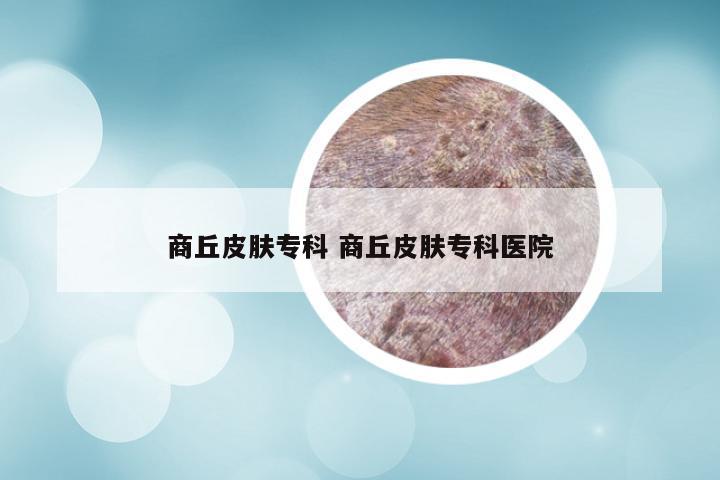 商丘皮肤专科 商丘皮肤专科医院