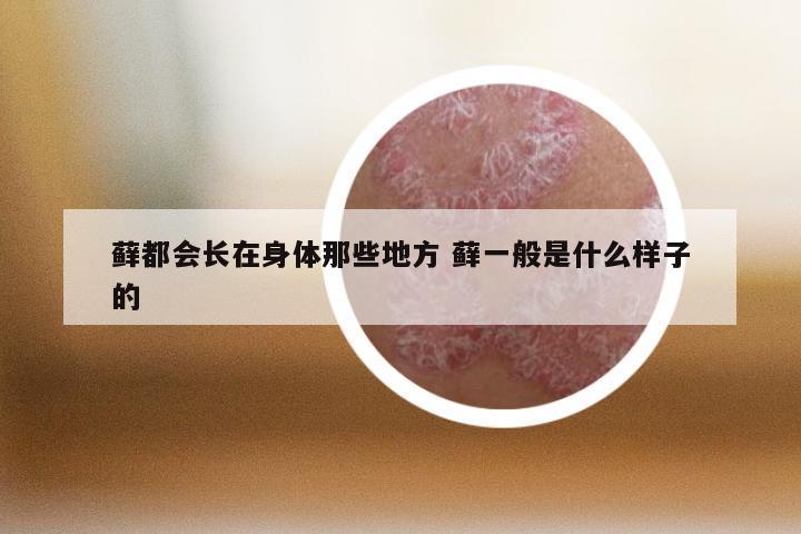 藓都会长在身体那些地方 藓一般是什么样子的