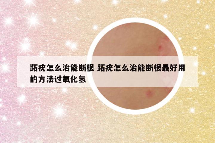 跖疣怎么治能断根 跖疣怎么治能断根最好用的方法过氧化氢