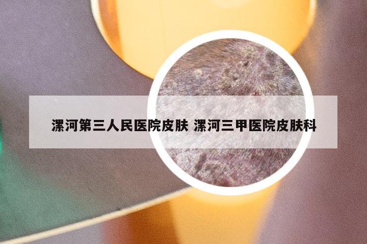 漯河第三人民医院皮肤 漯河三甲医院皮肤科
