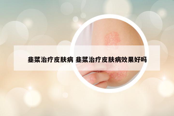 韭菜治疗皮肤病 韭菜治疗皮肤病效果好吗