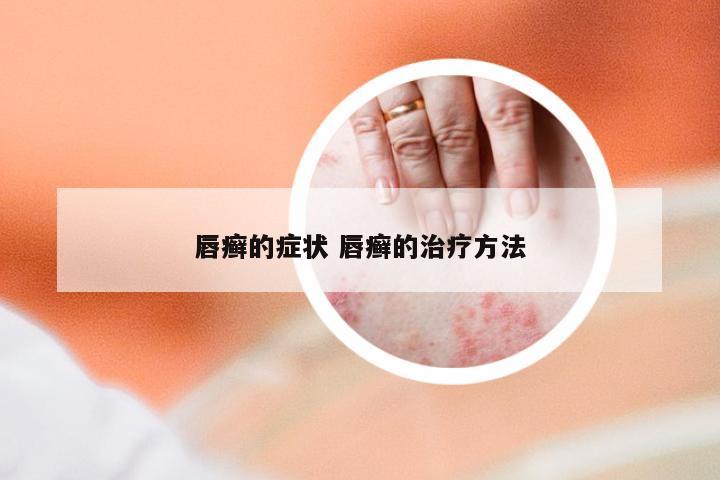 唇癣的症状 唇癣的治疗方法