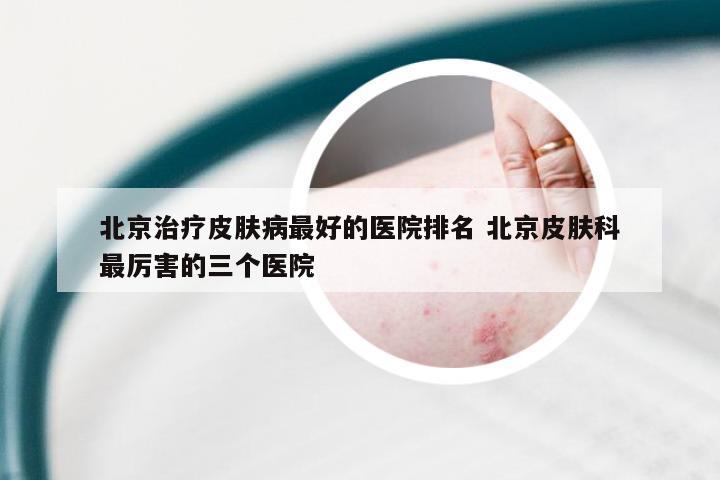 北京治疗皮肤病最好的医院排名 北京皮肤科最厉害的三个医院