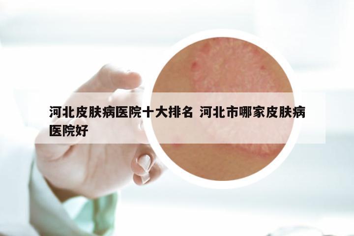 河北皮肤病医院十大排名 河北市哪家皮肤病医院好