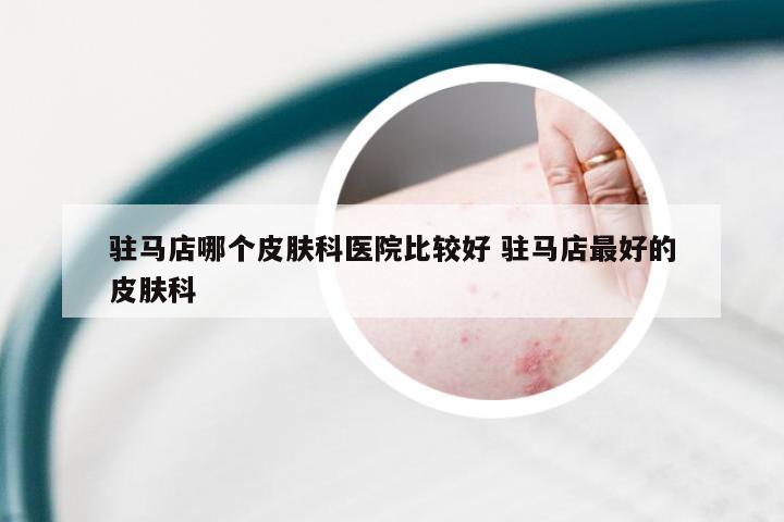 驻马店哪个皮肤科医院比较好 驻马店最好的皮肤科