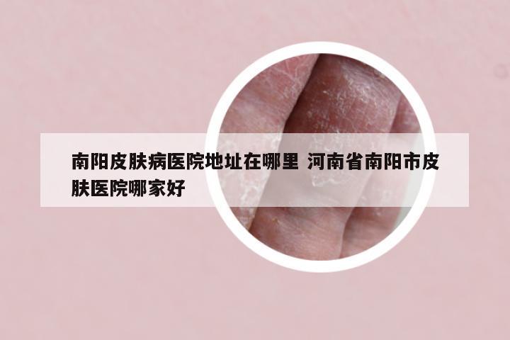 南阳皮肤病医院地址在哪里 河南省南阳市皮肤医院哪家好