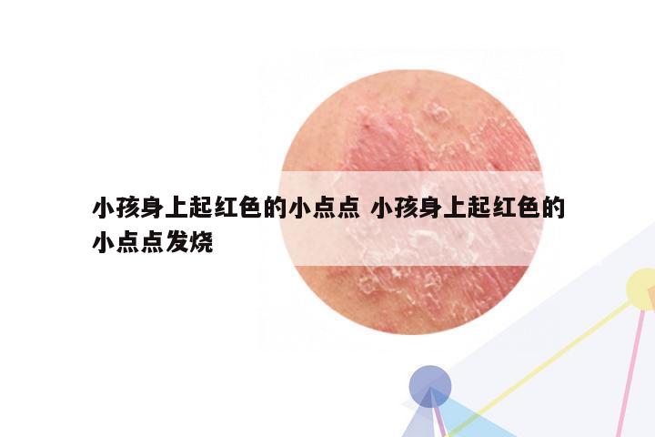 小孩身上起红色的小点点 小孩身上起红色的小点点发烧