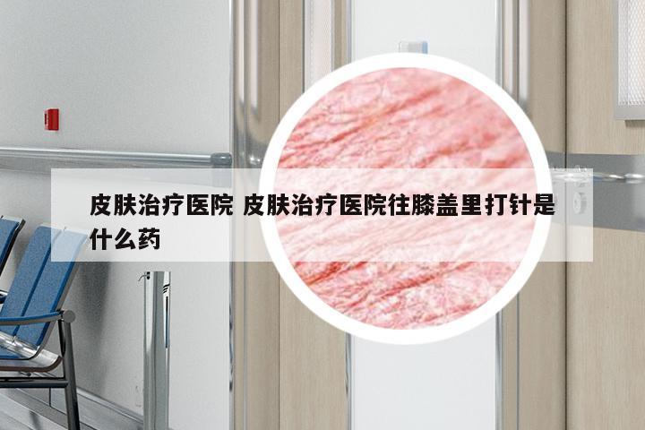 皮肤治疗医院 皮肤治疗医院往膝盖里打针是什么药