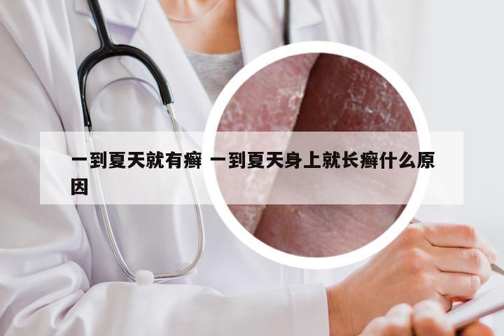 一到夏天就有癣 一到夏天身上就长癣什么原因