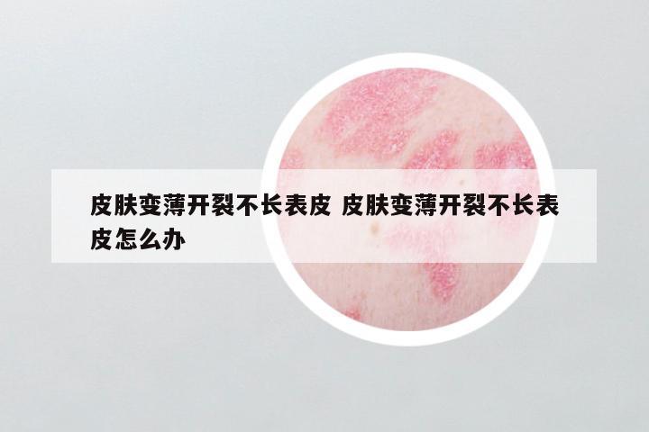 皮肤变薄开裂不长表皮 皮肤变薄开裂不长表皮怎么办