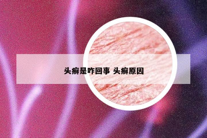 头癣是咋回事 头癣原因