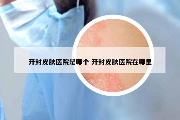 开封皮肤医院是哪个 开封皮肤医院在哪里
