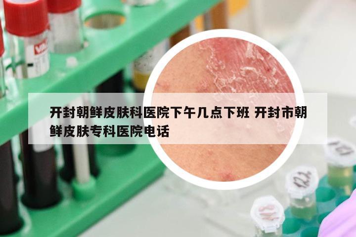 开封朝鲜皮肤科医院下午几点下班 开封市朝鲜皮肤专科医院电话