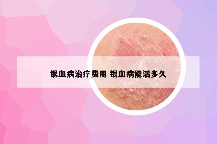 银血病治疗费用 银血病能活多久
