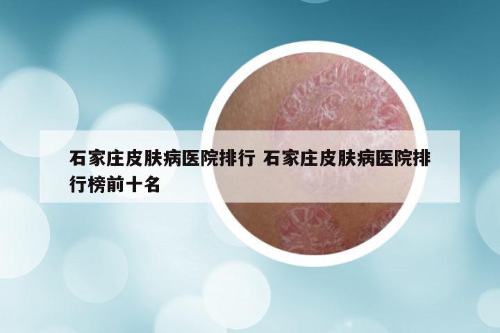 石家庄皮肤病医院排行 石家庄皮肤病医院排行榜前十名