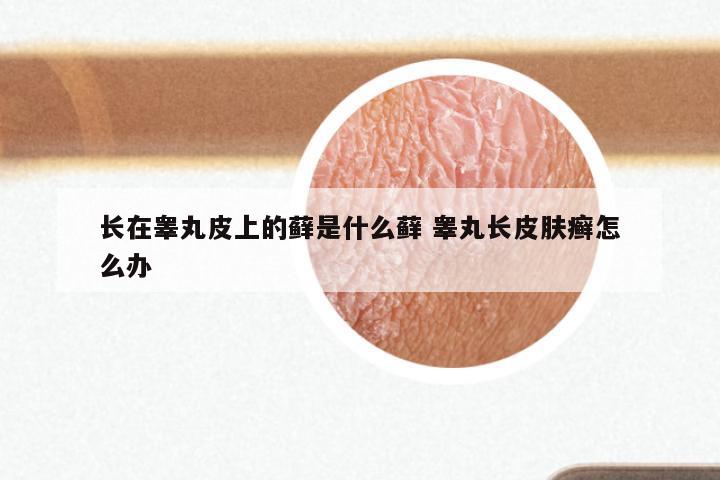 长在睾丸皮上的藓是什么藓 睾丸长皮肤癣怎么办