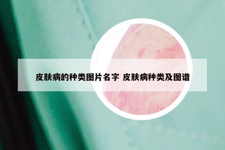 皮肤病的种类图片名字 皮肤病种类及图谱