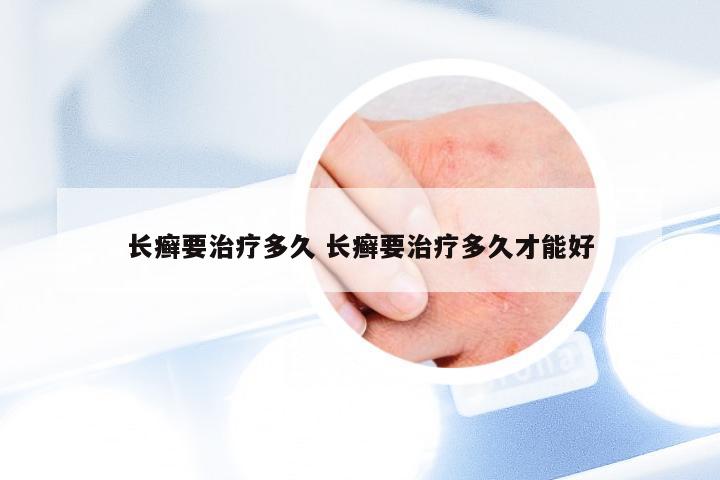 长癣要治疗多久 长癣要治疗多久才能好