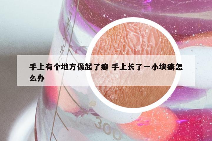 手上有个地方像起了癣 手上长了一小块癣怎么办