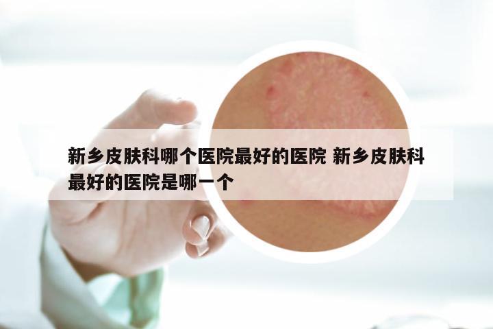 新乡皮肤科哪个医院最好的医院 新乡皮肤科最好的医院是哪一个
