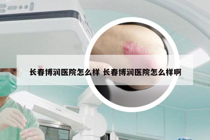 长春博润医院怎么样 长春博润医院怎么样啊