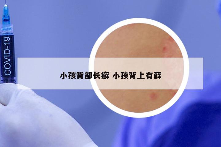 小孩背部长癣 小孩背上有藓