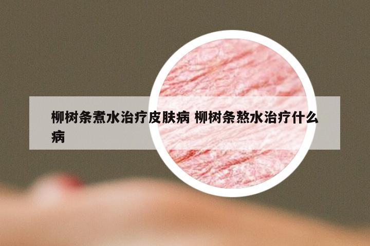 柳树条煮水治疗皮肤病 柳树条熬水治疗什么病
