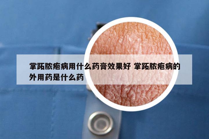 掌跖脓疱病用什么药膏效果好 掌跖脓疱病的外用药是什么药