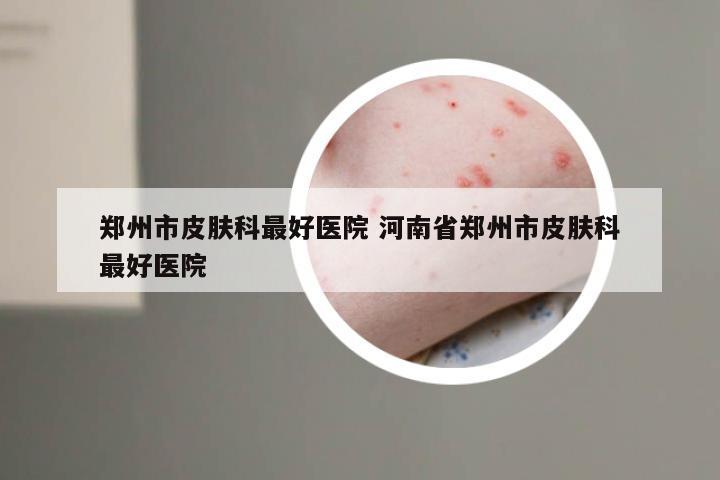 郑州市皮肤科最好医院 河南省郑州市皮肤科最好医院