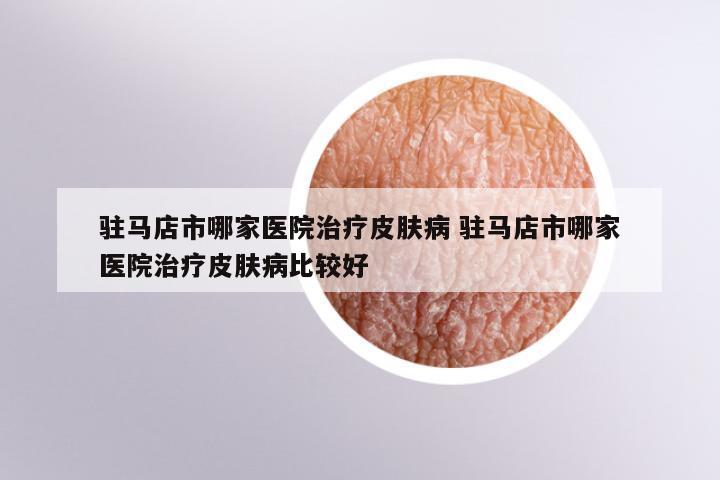 驻马店市哪家医院治疗皮肤病 驻马店市哪家医院治疗皮肤病比较好