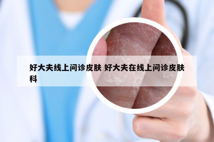 好大夫线上问诊皮肤 好大夫在线上问诊皮肤科