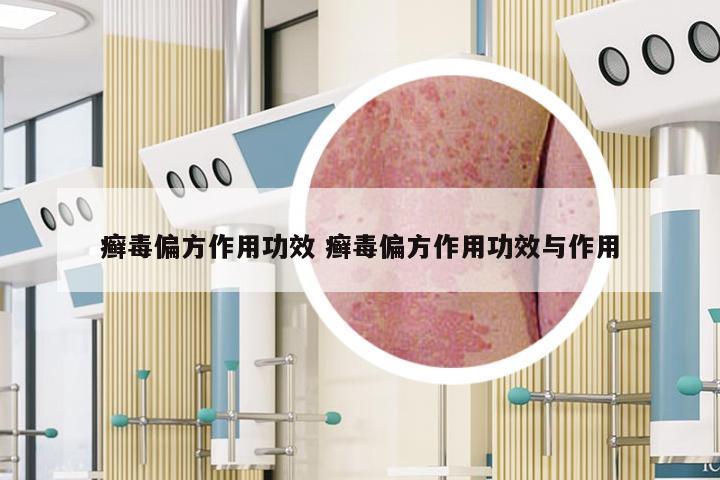 癣毒偏方作用功效 癣毒偏方作用功效与作用