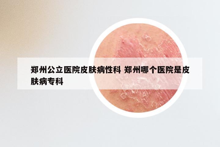 郑州公立医院皮肤病性科 郑州哪个医院是皮肤病专科