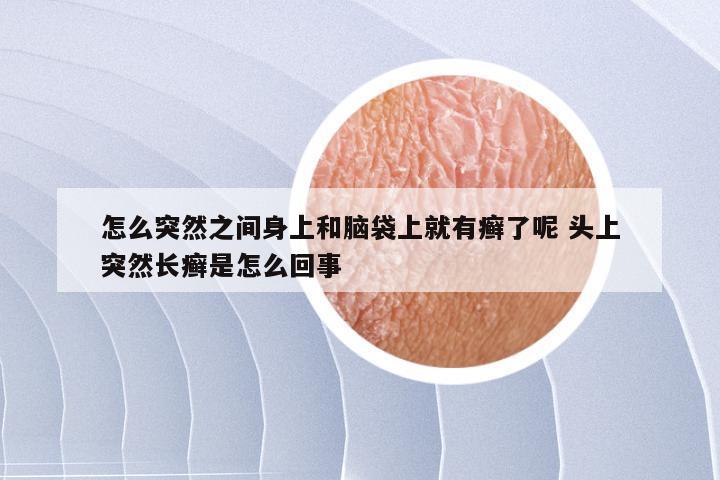 怎么突然之间身上和脑袋上就有癣了呢 头上突然长癣是怎么回事