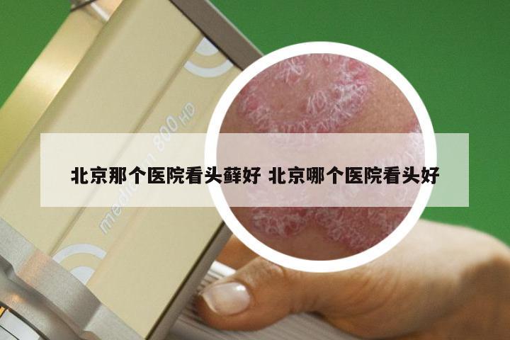 北京那个医院看头藓好 北京哪个医院看头好