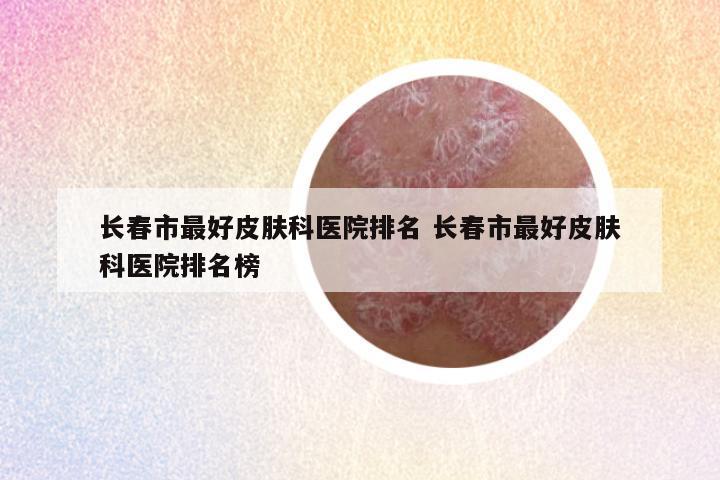 长春市最好皮肤科医院排名 长春市最好皮肤科医院排名榜