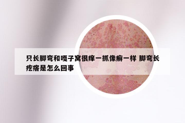 只长脚弯和嘎子窝很痒一抓像癣一样 脚弯长疙瘩是怎么回事